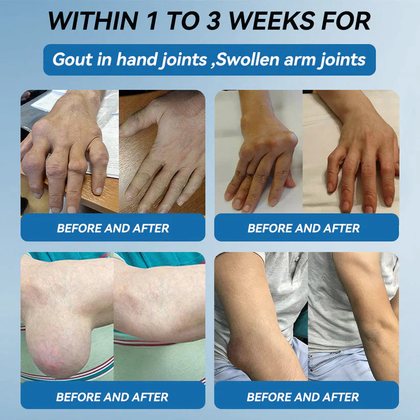 SoothePro™ - BPC-157 Joint Healing Cream