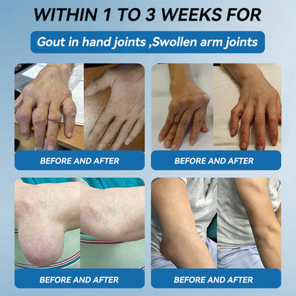 SoothePro™ - BPC-157 Joint Healing Cream